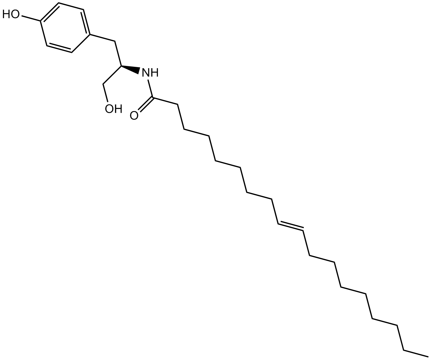 OMDM-2