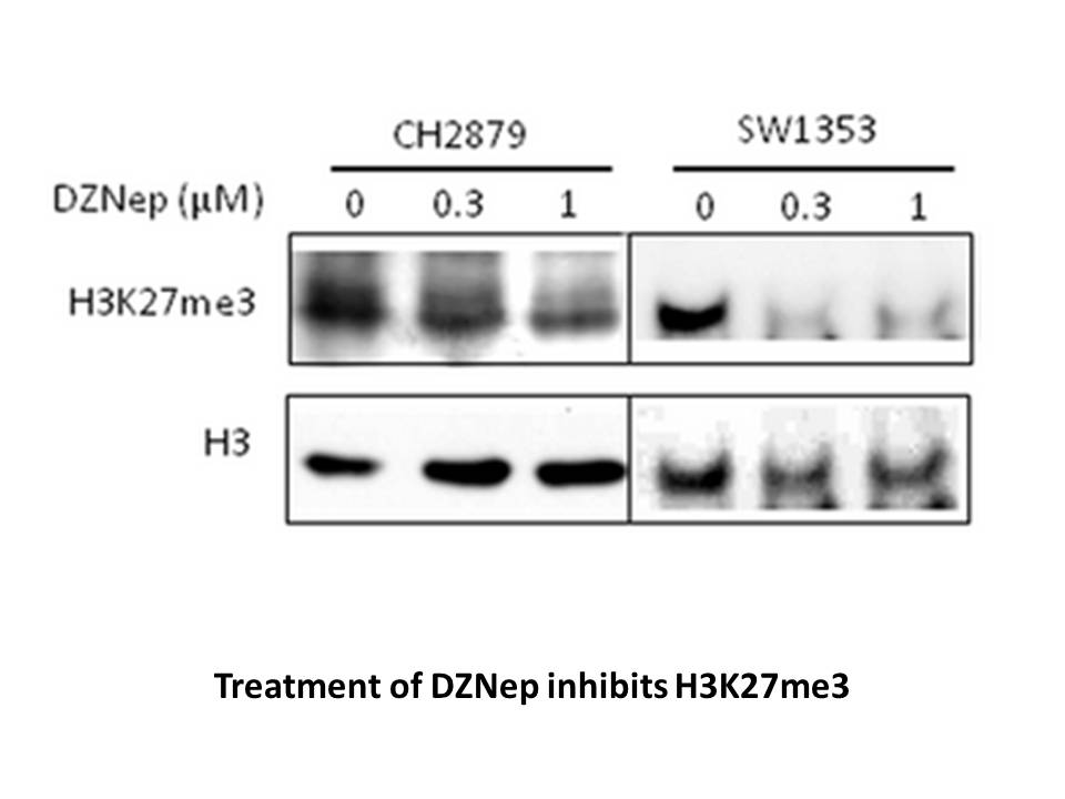 3-Deazaneplanocin,DZNep