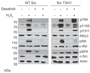 Dasatinib