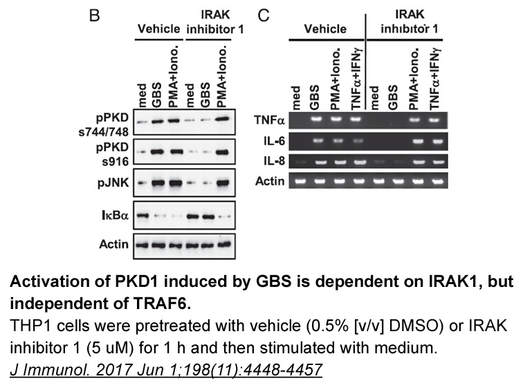 IRAK inhibitor