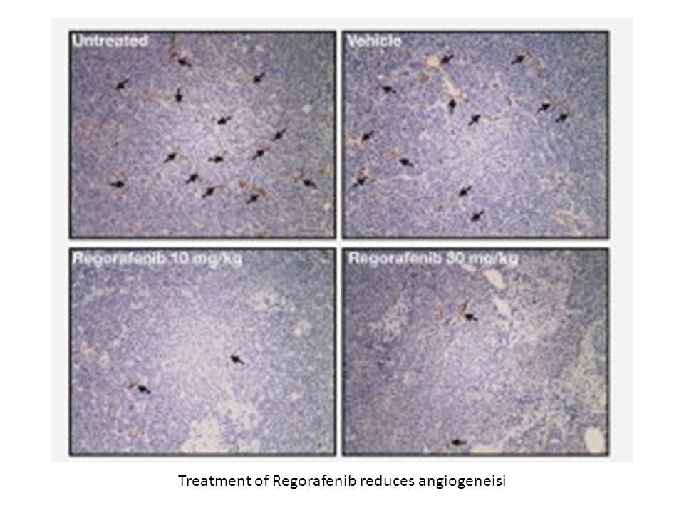 Regorafenib hydrochloride