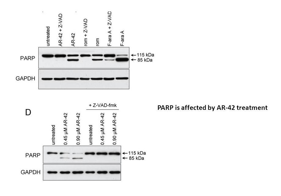 AR-42 (OSU-HDAC42)