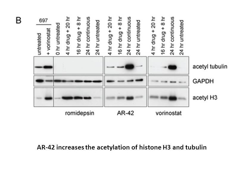 AR-42 (OSU-HDAC42)