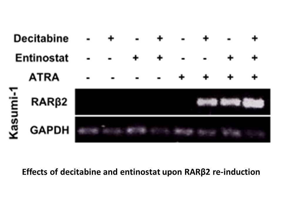 Entinostat (MS-275,SNDX-275)