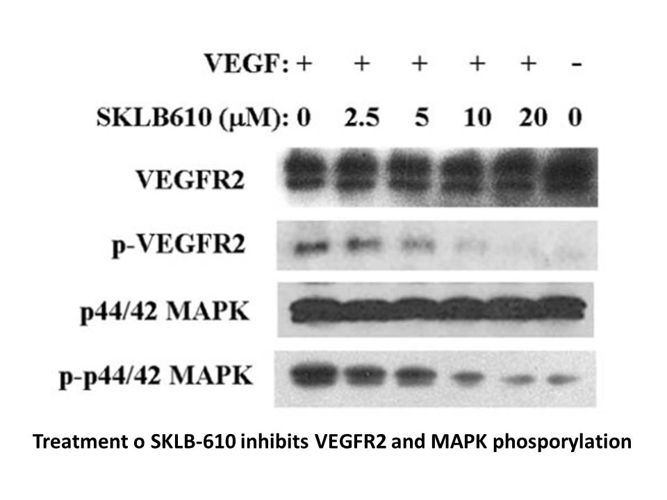 SKLB610