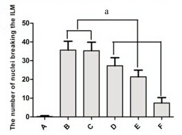 Sorafenib Tosylate