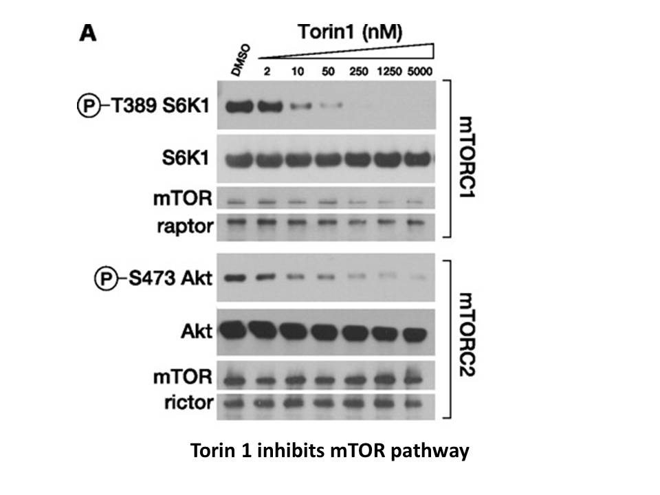 Torin 1 Torin 1