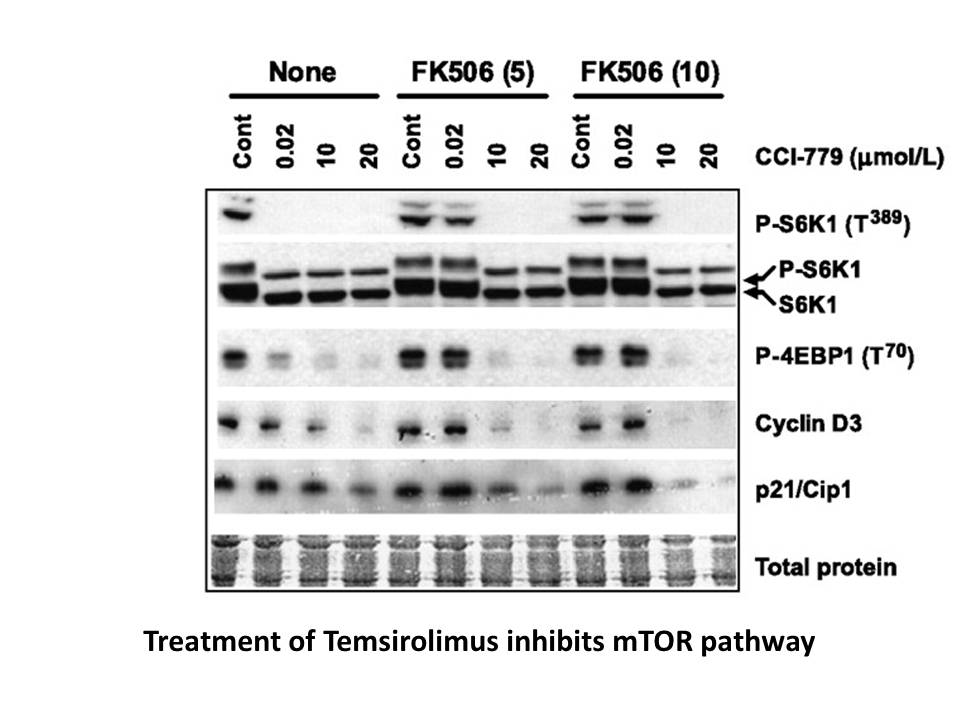 Temsirolimus