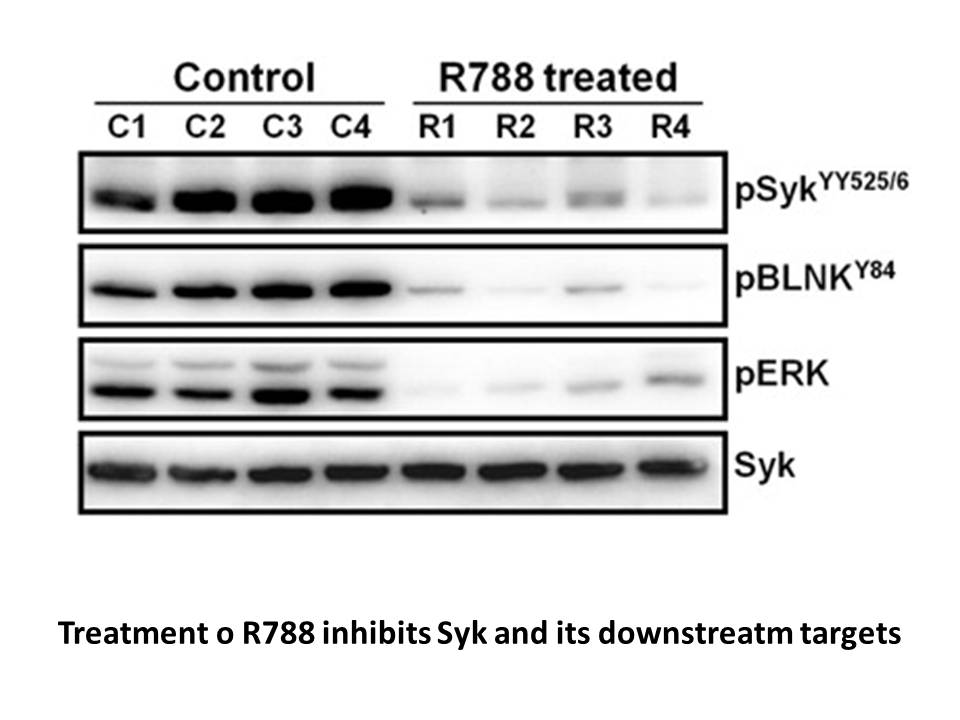 Fostamatinib (R788)