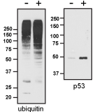 Epoxomicin