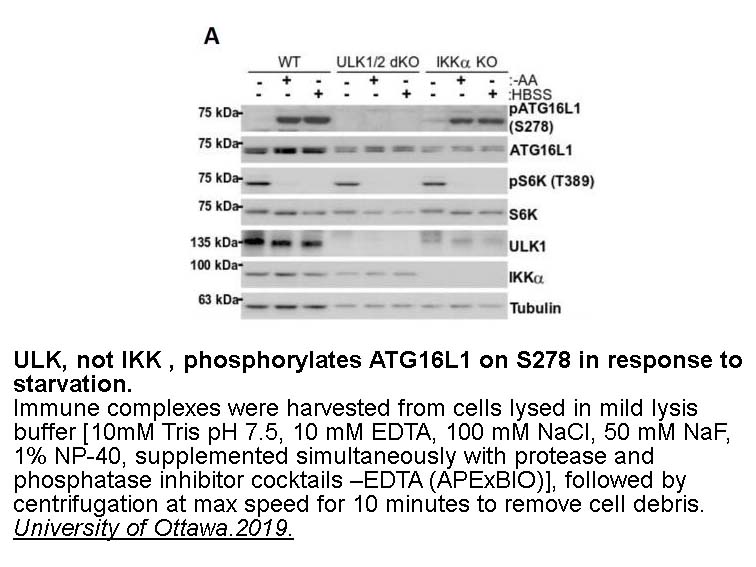 Phosphatase Inhibitor Cocktail (2 Tubes, 100X)