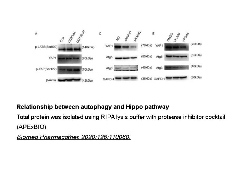 Phosphatase Inhibitor Cocktail (2 Tubes, 100X)