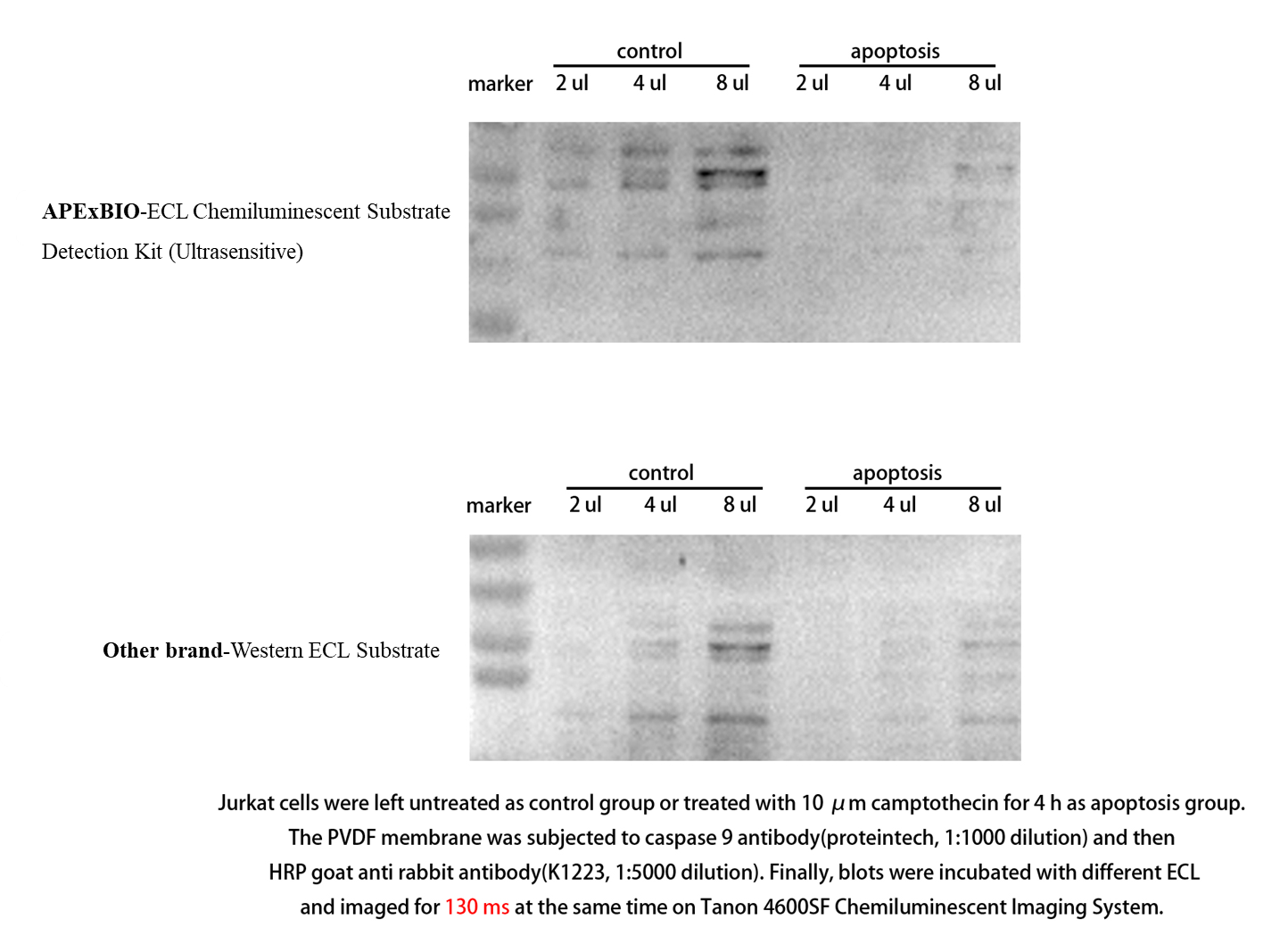 ECL Chemiluminescent Substrate Detection Kit (Ultrasensitive)