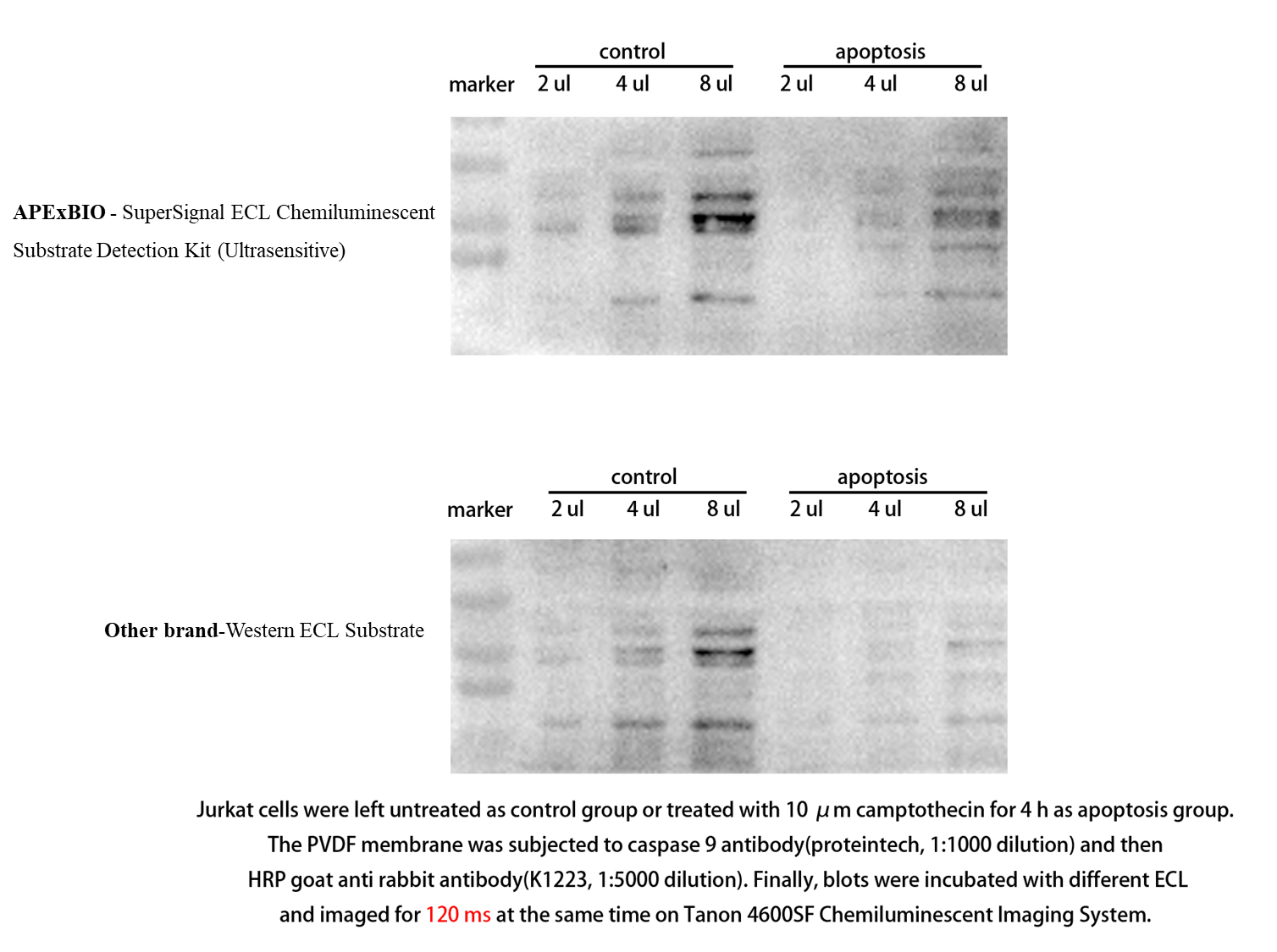 SuperSignal ECL Chemiluminescent Substrate Detection Kit (Ultrasensitive)