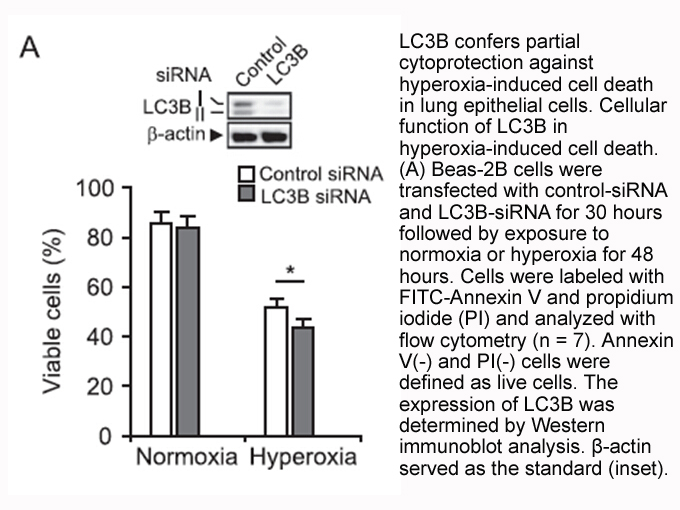 Annexin V-FITC/PI Apoptosis Kit