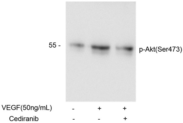 Cediranib (AZD217)