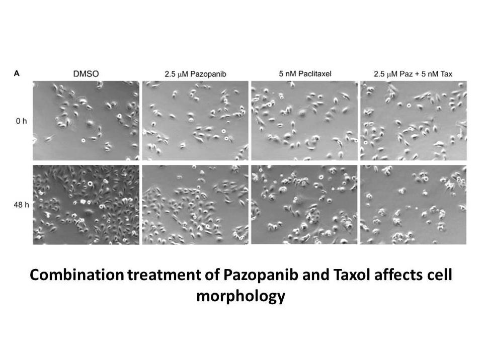 Pazopanib