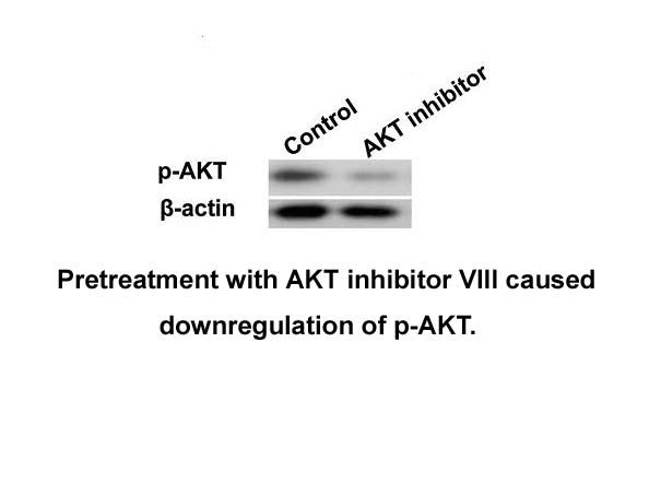 AKT inhibitor VIII AKT inhibitor VIII