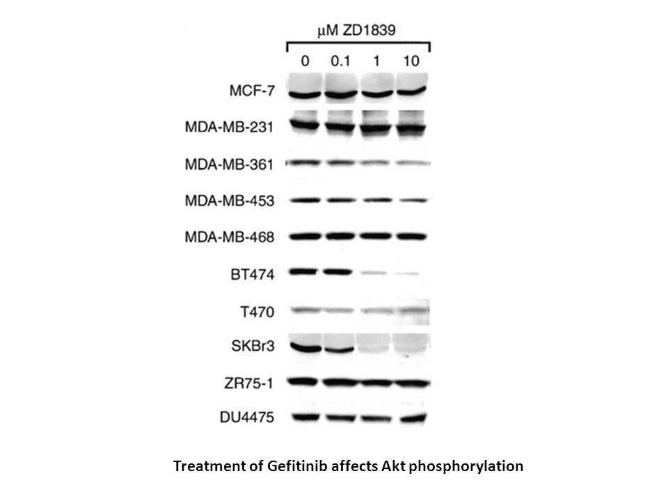 Gefitinib hydrochloride Gefitinib hydrochloride