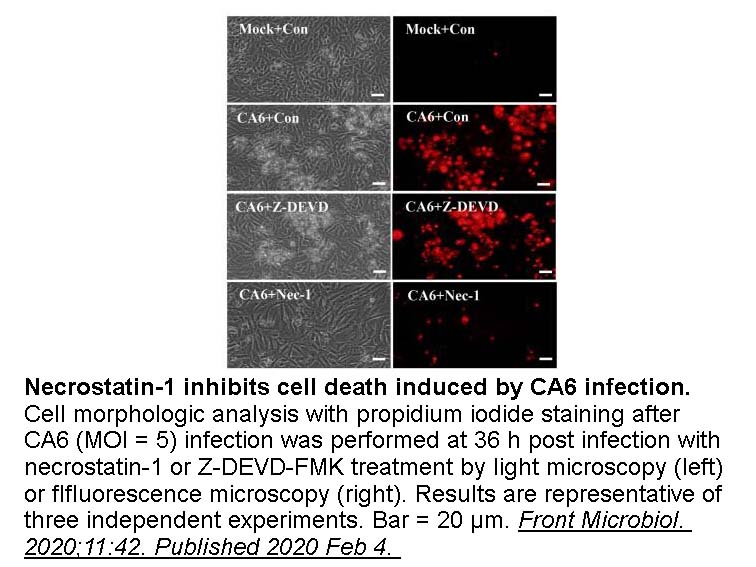 Necrostatin-1 Necrostatin-1