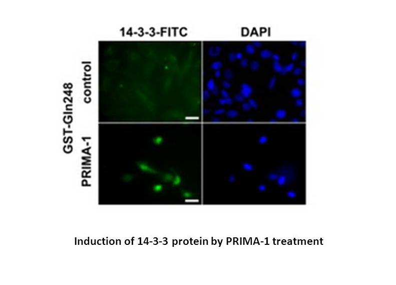 PRIMA-1 PRIMA-1