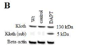 DAPT