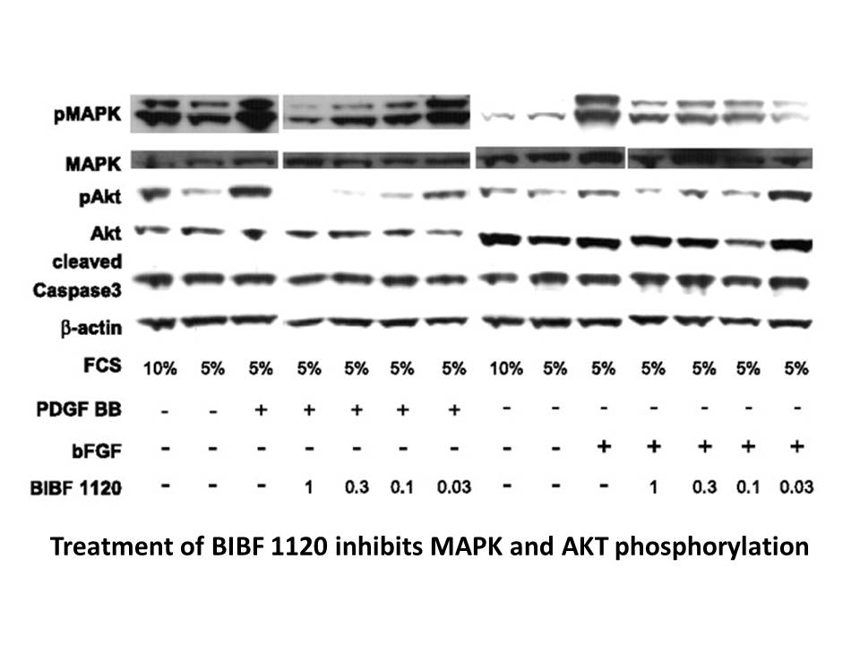 Nintedanib(BIBF 1120)