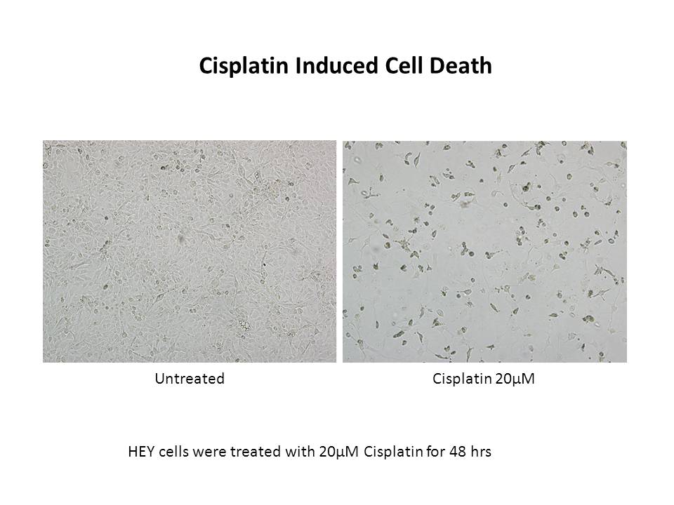Cisplatin Cisplatin