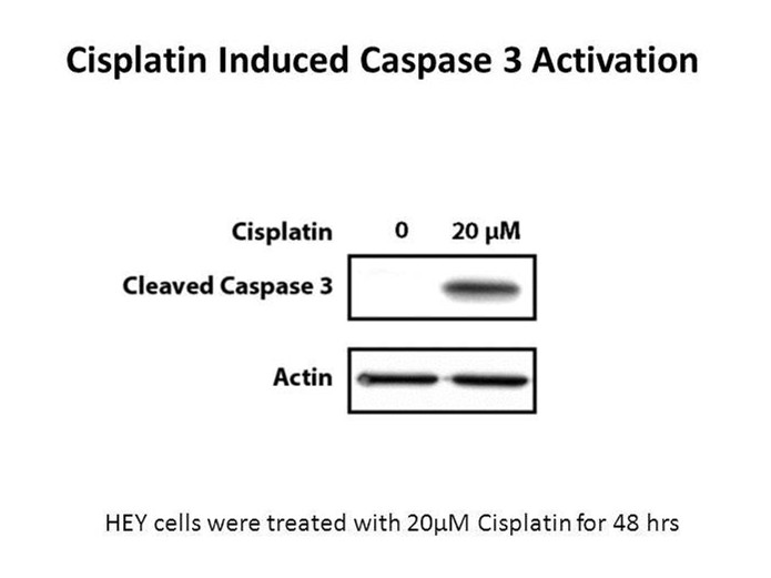 Cisplatin Cisplatin