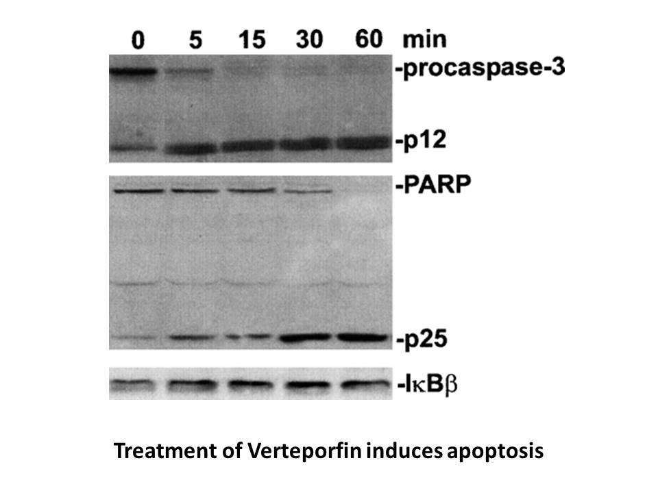 Verteporfin