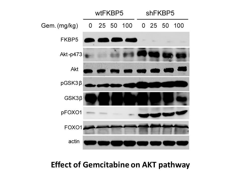 Gemcitabine Gemcitabine