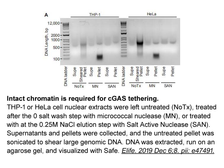 Safe DNA Gel Stain