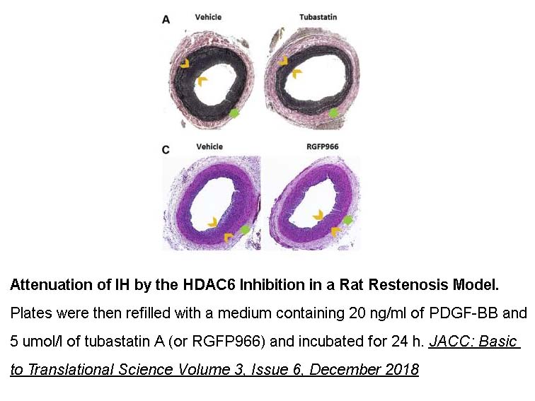 RGFP966 RGFP966