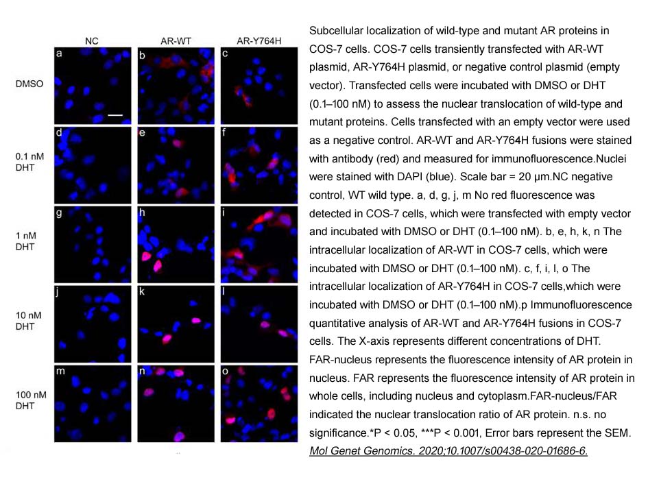 Dihydrotestosterone(DHT)