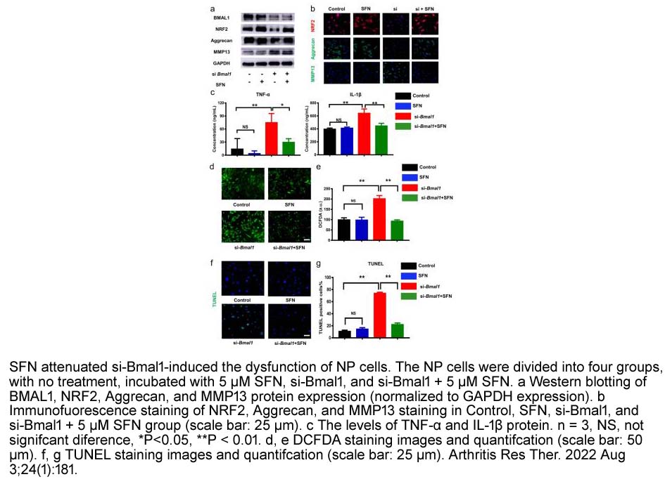 Sulforaphane Sulforaphane