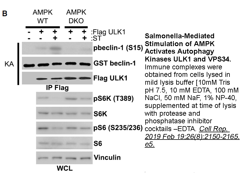 Protease Inhibitor Cocktail