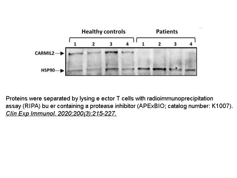 Protease Inhibitor Cocktail