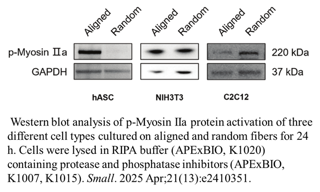 Protease Inhibitor Cocktail Protease Inhibitor Cocktail