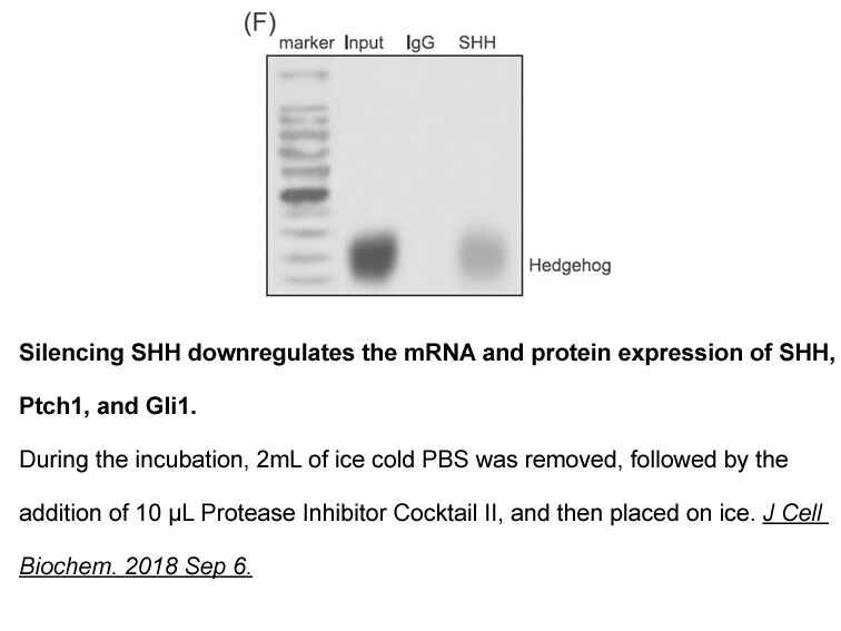 Protease Inhibitor Cocktail Protease Inhibitor Cocktail