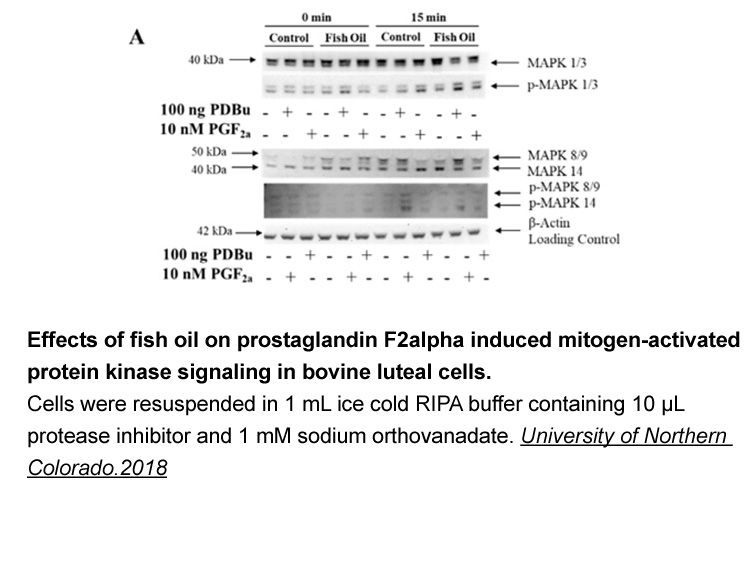 Protease Inhibitor Cocktail Protease Inhibitor Cocktail