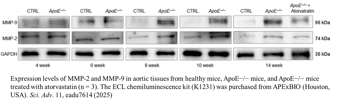 ECL Chemiluminescent Substrate Detection Kit (Hypersensitive)