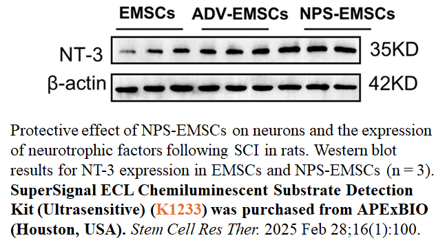 SuperSignal ECL Chemiluminescent Substrate Detection Kit (Ultrasensitive) SuperSignal ECL Chemiluminescent Substrate Detection Kit (Ultrasensitive)