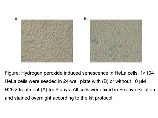Senescence Detection Kit Senescence Detection Kit