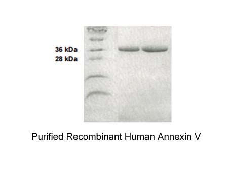 Annexin V, human recombinant
