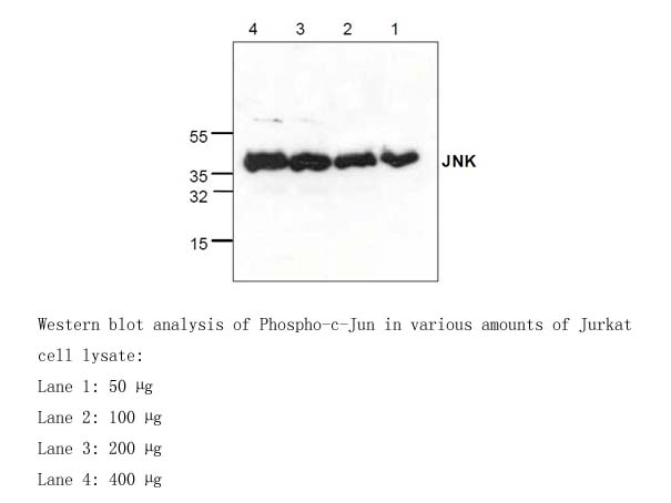 KinaseSTAR JNK Activity Assay Kit KinaseSTAR JNK Activity Assay Kit