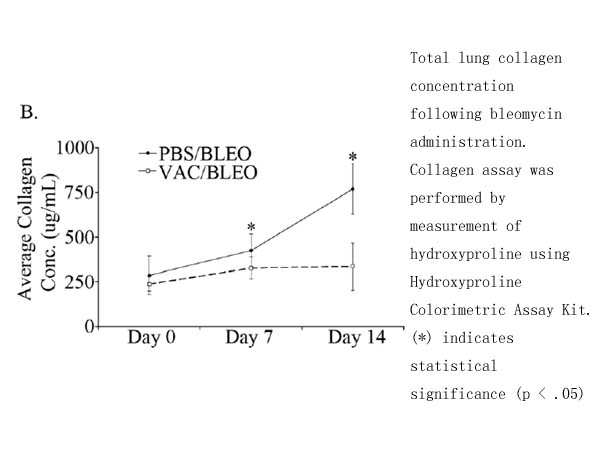 Hydroxyproline Colorimetric Assay Kit