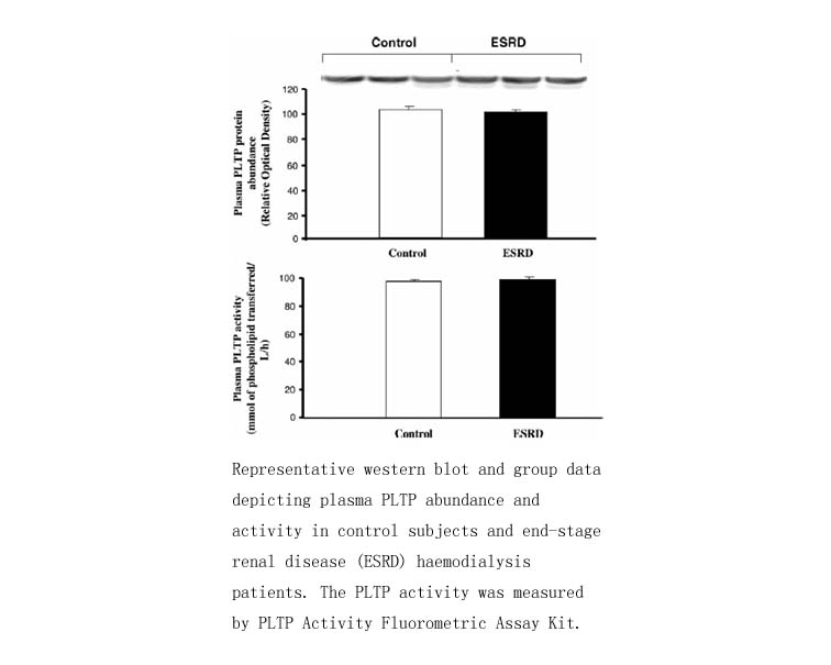 PLTP Activity Fluorometric Assay Kit PLTP Activity Fluorometric Assay Kit