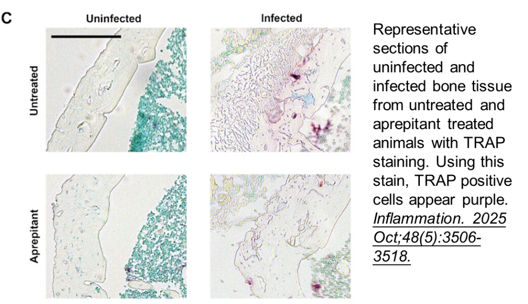 Tartrate Resistant Acid Phosphatase (TRAP) staining Kit Tartrate Resistant Acid Phosphatase (TRAP) staining Kit