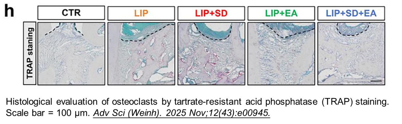Tartrate Resistant Acid Phosphatase (TRAP) staining Kit Tartrate Resistant Acid Phosphatase (TRAP) staining Kit