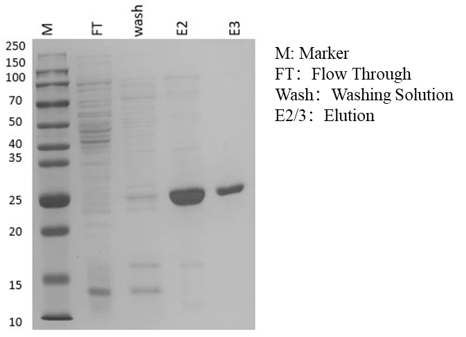 His-tag Protein Purification Kit (Denaturant)